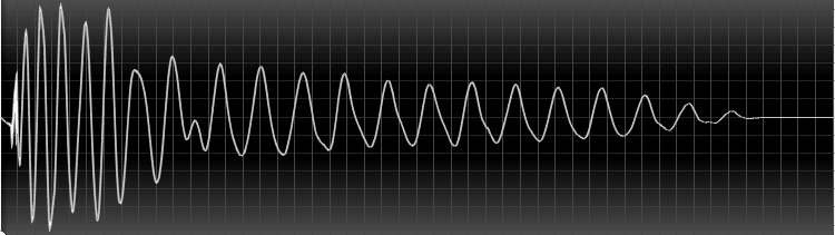 FAQ: Was sind Transienten?