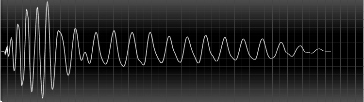 FAQ: Was sind Transienten?